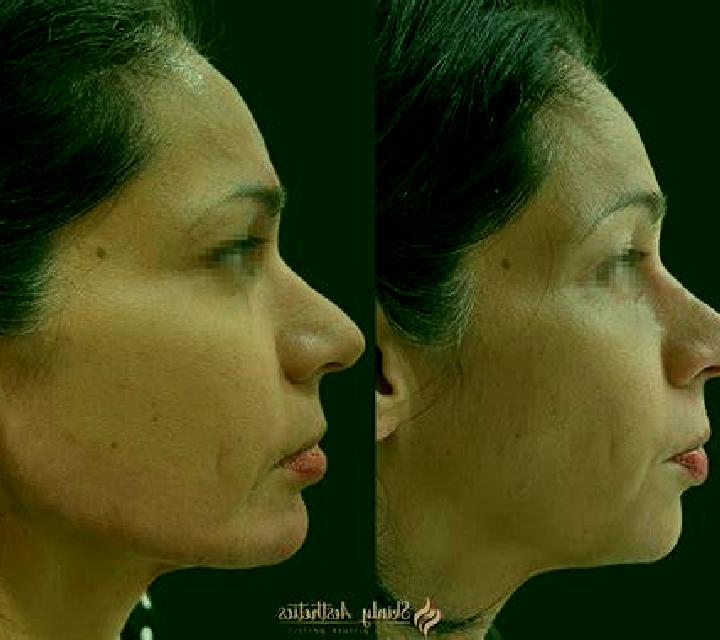 Flora s Secret slot game